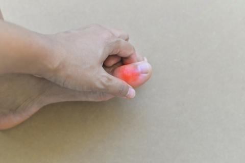 jicht