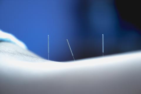 acupunctuur